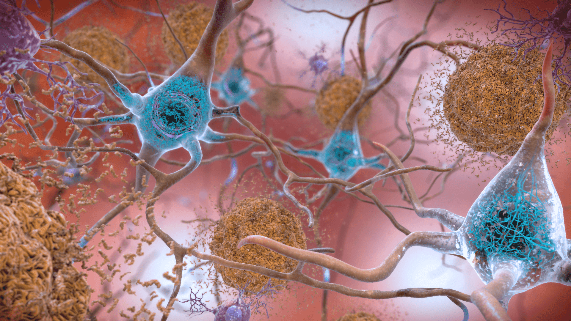 Beta-amyloid and Tau Proteins in Alzheimer's Disease SimpleMed Beta-amyloid and Tau Proteins in Alzheimer's Disease SimpleMed