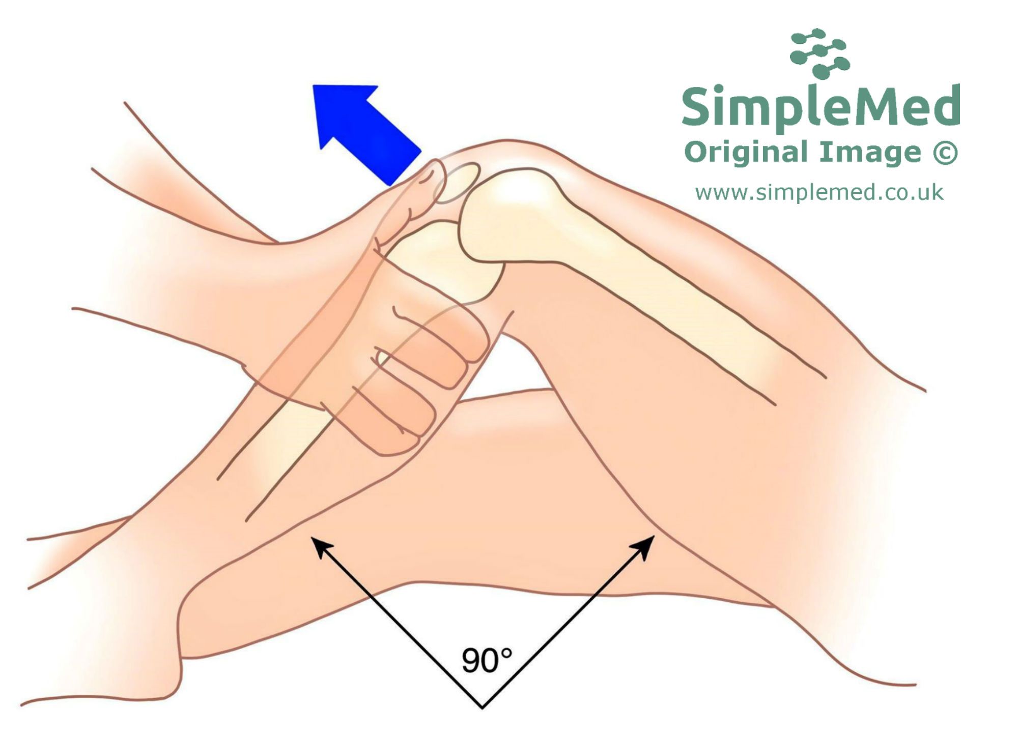 Anterior Drawer Test SimpleMed