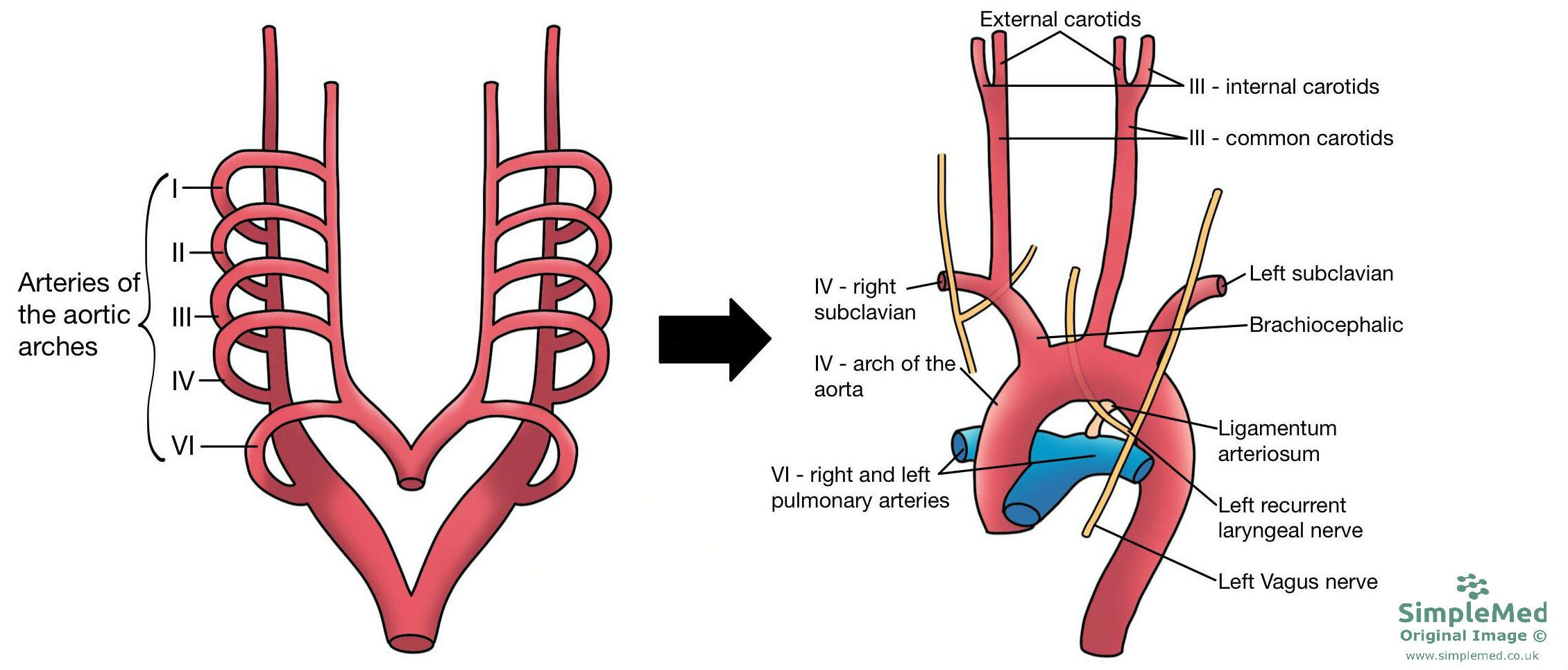 Aortic Arches SimpleMed Aortic Arches SimpleMed