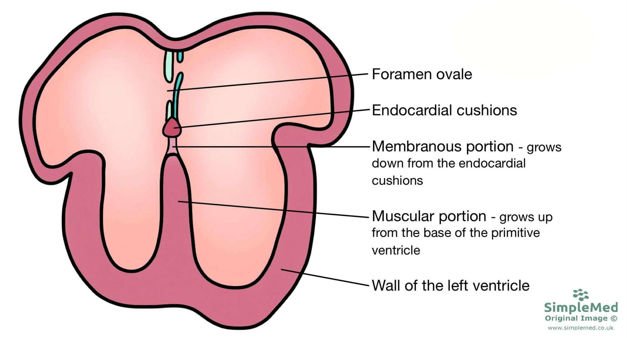 Ventricular Septum Formation SimpleMed Ventricular Septum Formation SimpleMed