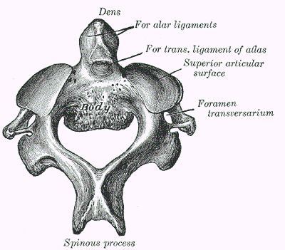 Axis Vertebra SimpleMed Axis Vertebra SimpleMed
