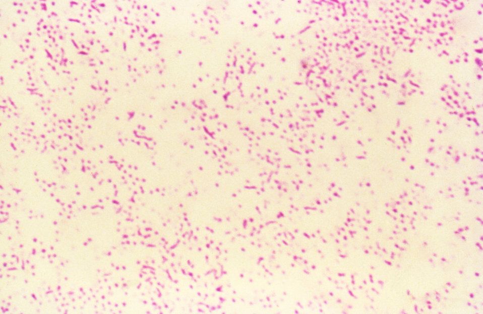 Campylobacter Jejuni Gram Stain SimpleMed Campylobacter Jejuni Gram Stain SimpleMed