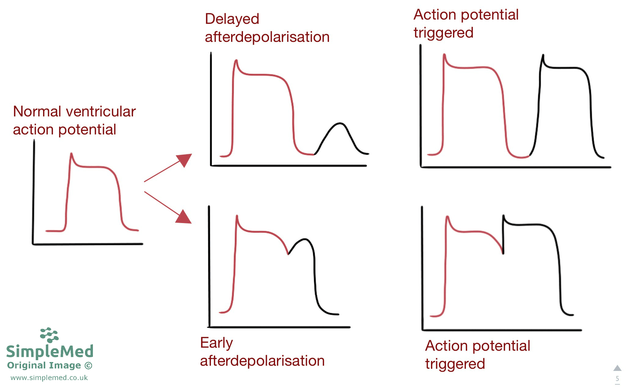 Early and Delayed Afterdepolarisations ECG SimpleMed Early and Delayed Afterdepolarisations ECG SimpleMed