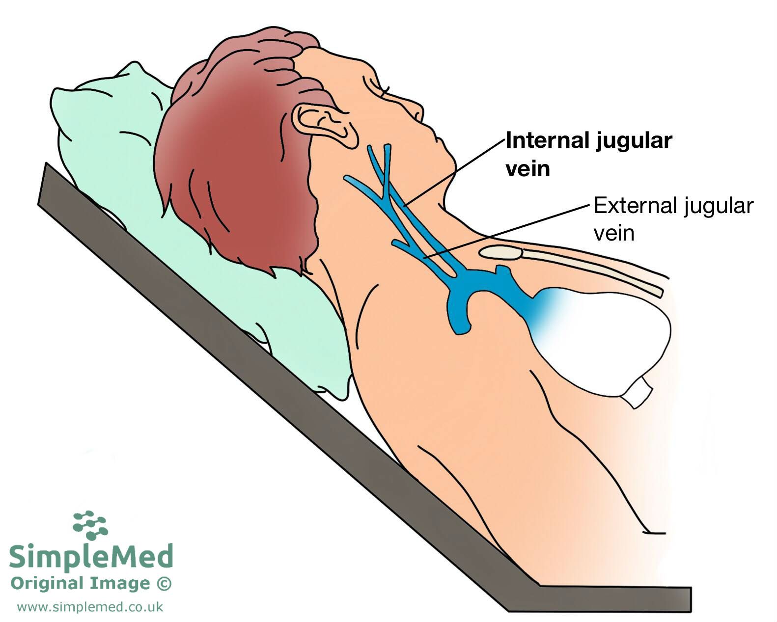 Jugular Venous Pressure SimpleMed Jugular Venous Pressure SimpleMed