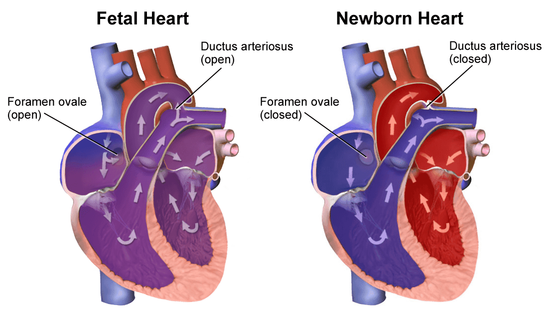 Changes in Heart After Birth SimpleMed Changes in Heart After Birth SimpleMed
