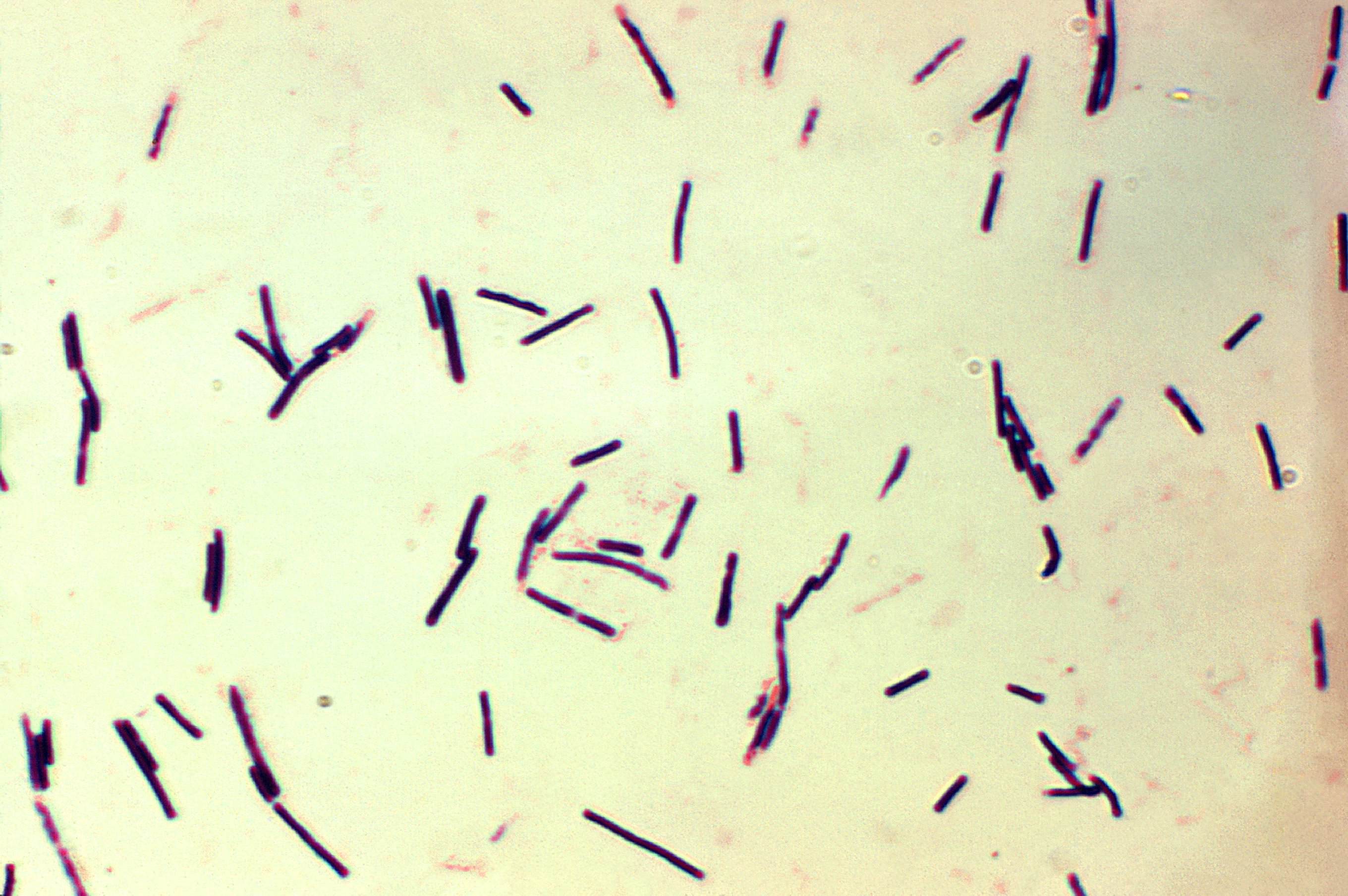 Clostridium Difficile Gram Stain SimpleMed Clostridium Difficile Gram Stain SimpleMed