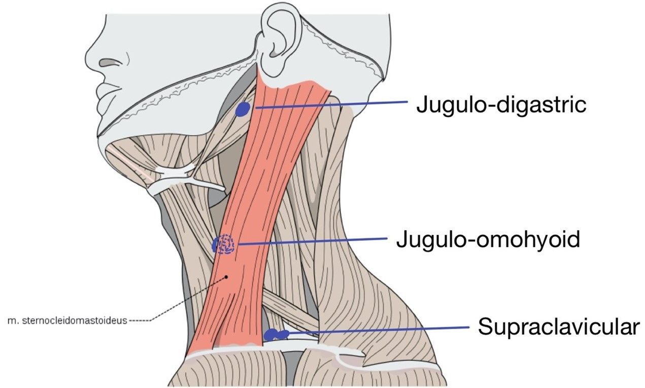 Deep Neck Lymph Nodes SimpleMed Deep Neck Lymph Nodes SimpleMed