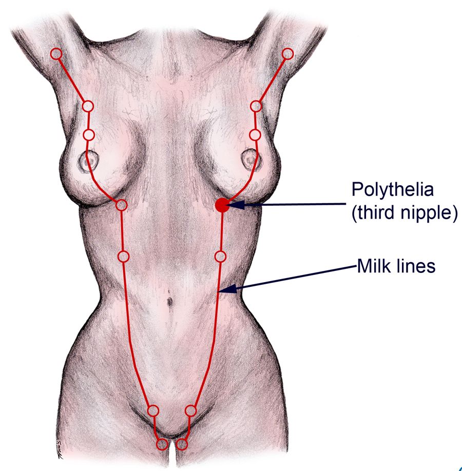 Embryological Mammary Streak/Milk Lines SimpleMed Embryological Mammary Streak/Milk Lines SimpleMed