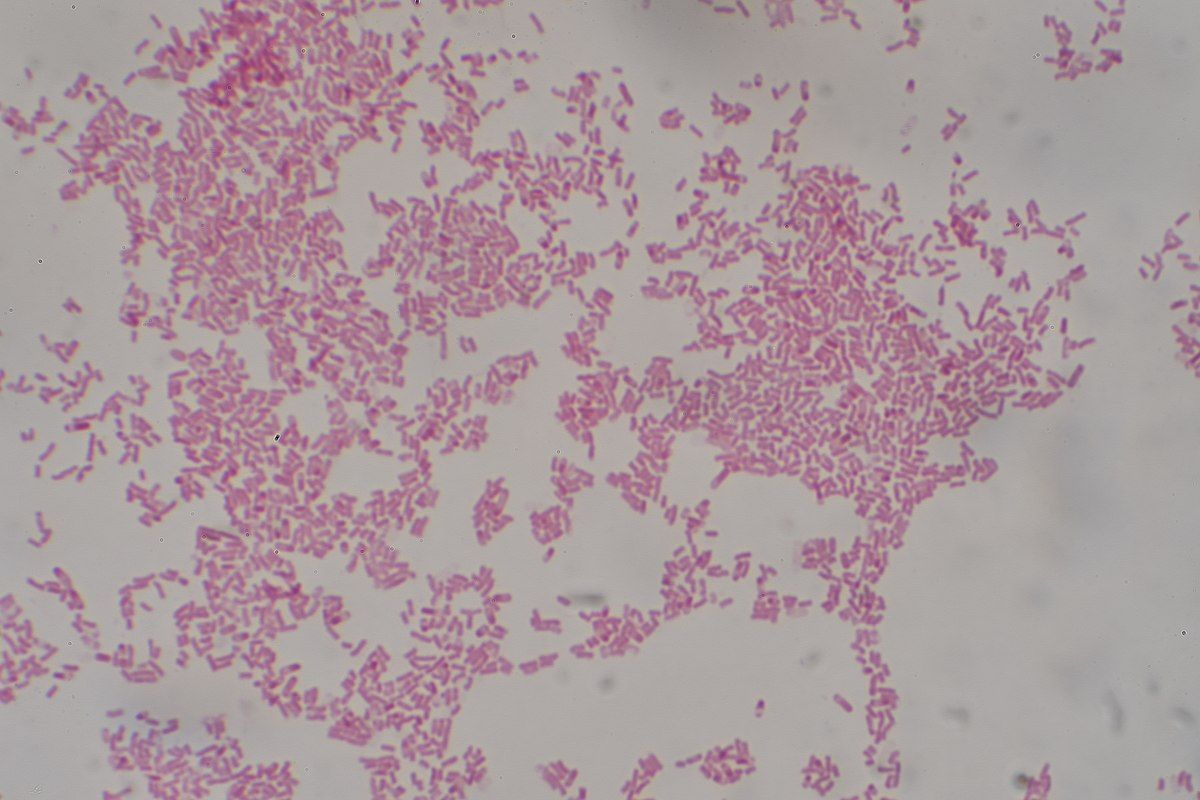 Escherichia Coli Gram Stain SimpleMed Escherichia Coli Gram Stain SimpleMed