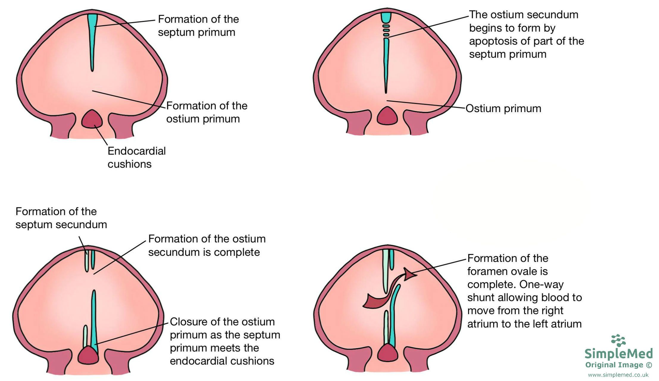 Formation of the Atrial Septum SimpleMed Formation of the Atrial Septum SimpleMed