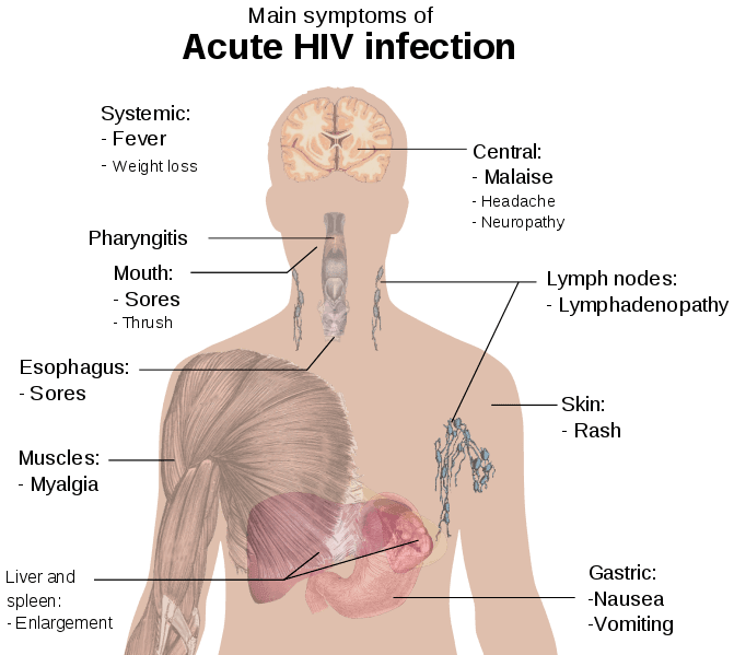 HIV Symptoms SimpleMed HIV Symptoms SimpleMed