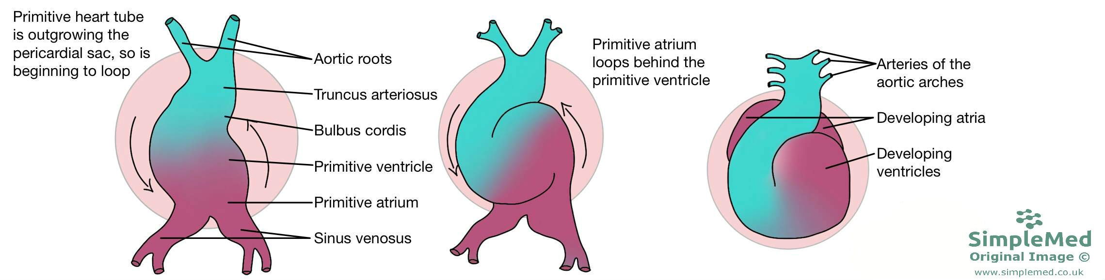 Heart Twisting Embryology SimpleMed Heart Twisting Embryology SimpleMed