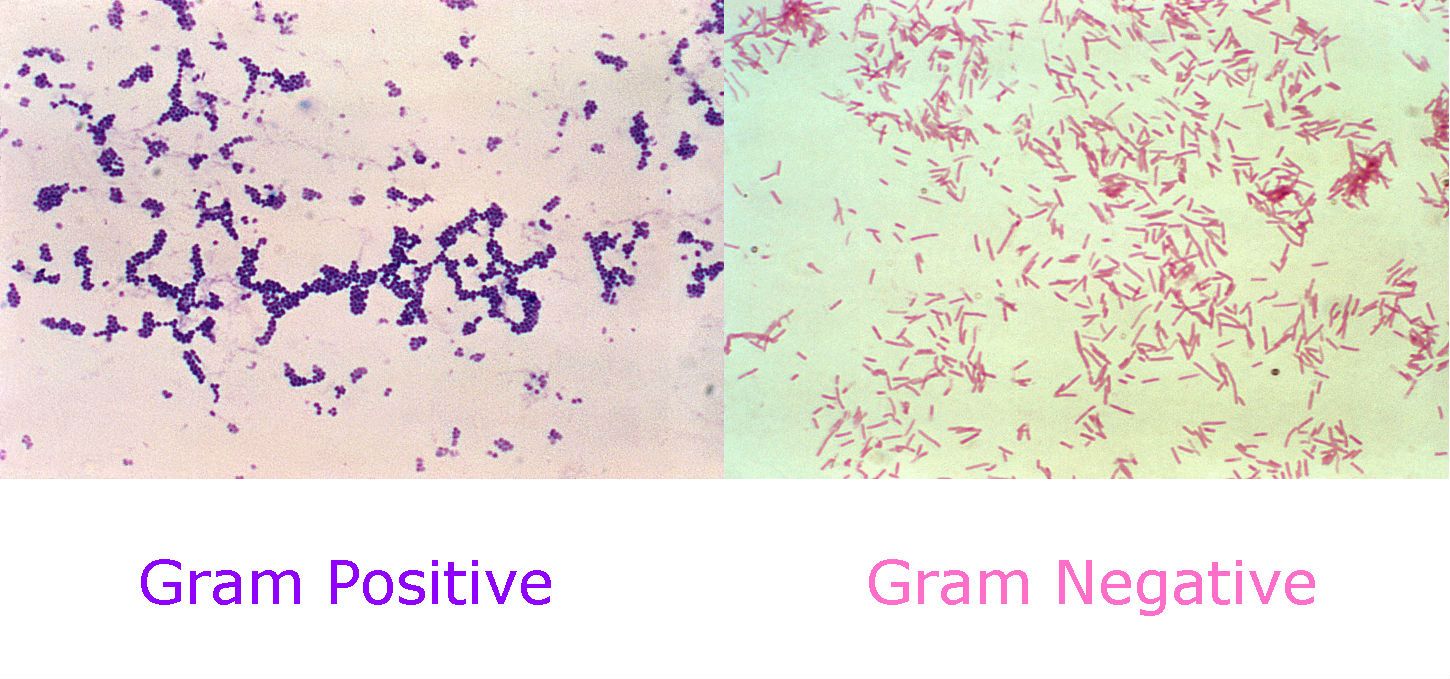 Gram Positive vs Gram Negative Gram Stain SimpleMed Gram Positive vs Gram Negative Gram Stain SimpleMed