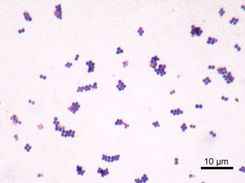 Staphylococcus Gram Stain - Diplococci SimpleMed Staphylococcus Gram Stain - Diplococci SimpleMed