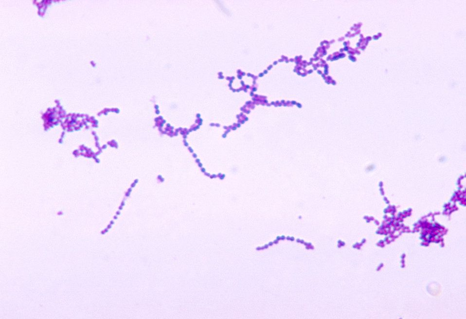 Streptococcus Gram Stain - Streps are Strips SimpleMed Streptococcus Gram Stain - Streps are Strips SimpleMed