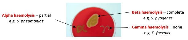 Streptococcal Haemolytic Patterns SimpleMed Streptococcal Haemolytic Patterns SimpleMed