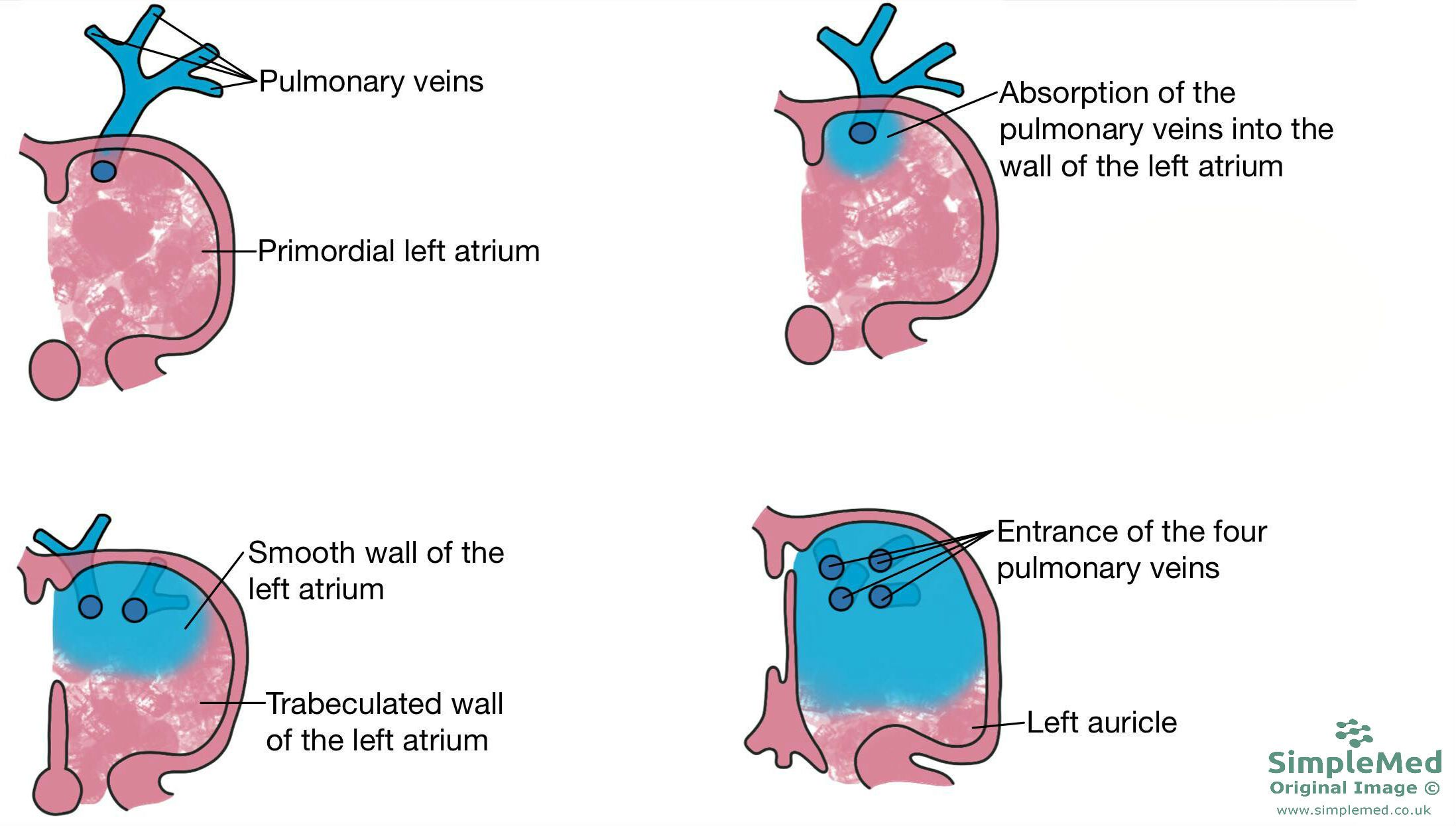 Left Atria Formation SimpleMed Left Atria Formation SimpleMed
