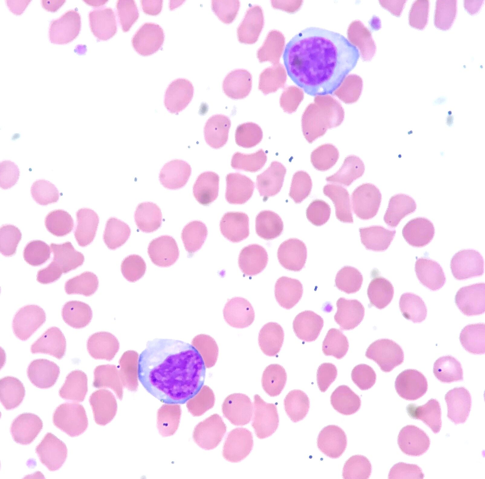 Lymphocyte Histology SimpleMed Lymphocyte Histology SimpleMed