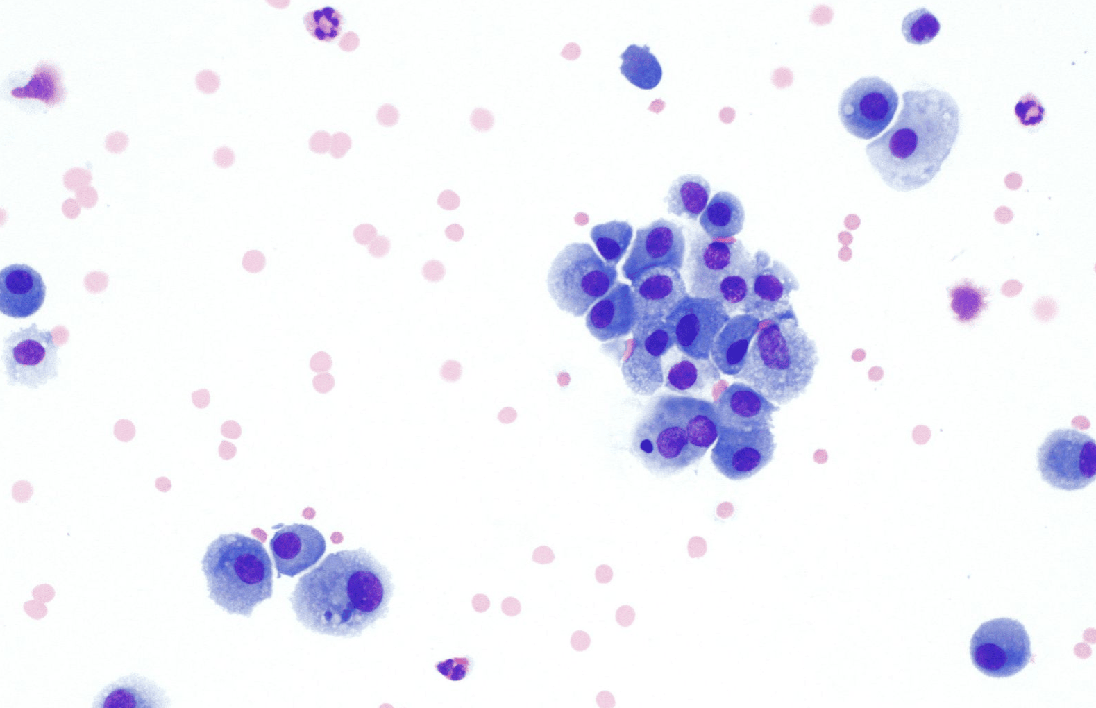 Macrophage Histology SimpleMed Macrophage Histology SimpleMed