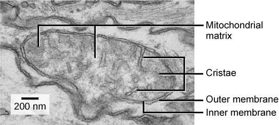 Mitochondria Microscope Labelled SimpleMed Mitochondria Microscope Labelled SimpleMed