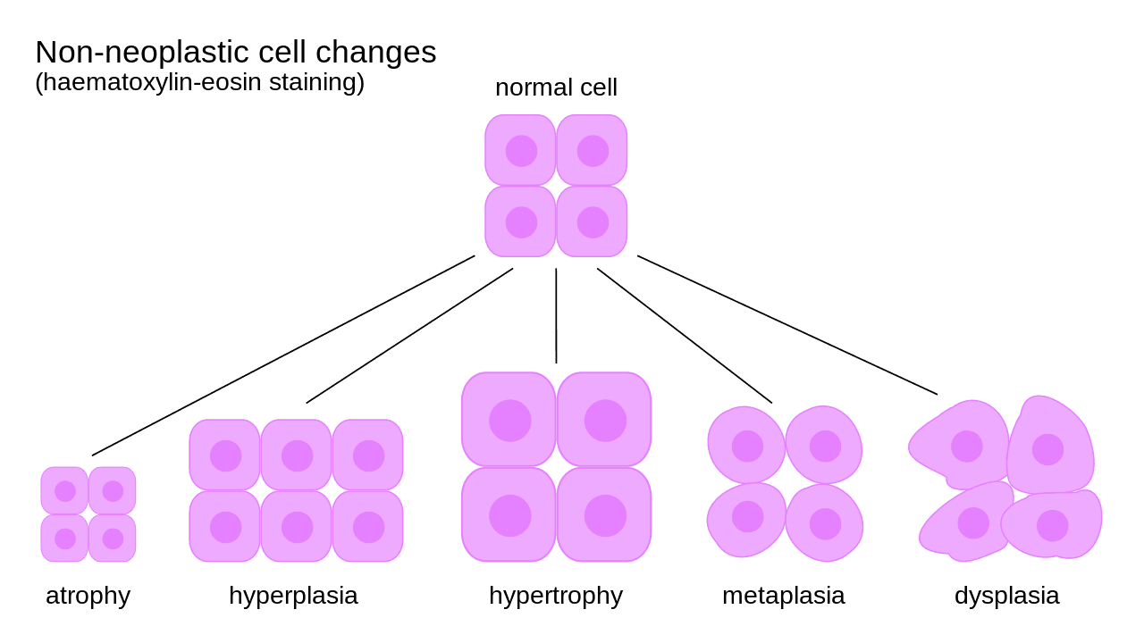 Non-Neoplastic Cell Changes SimpleMed Non-Neoplastic Cell Changes SimpleMed