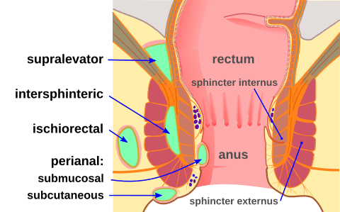 Locations of Perianal Abscesses SimpleMed Locations of Perianal Abscesses SimpleMed