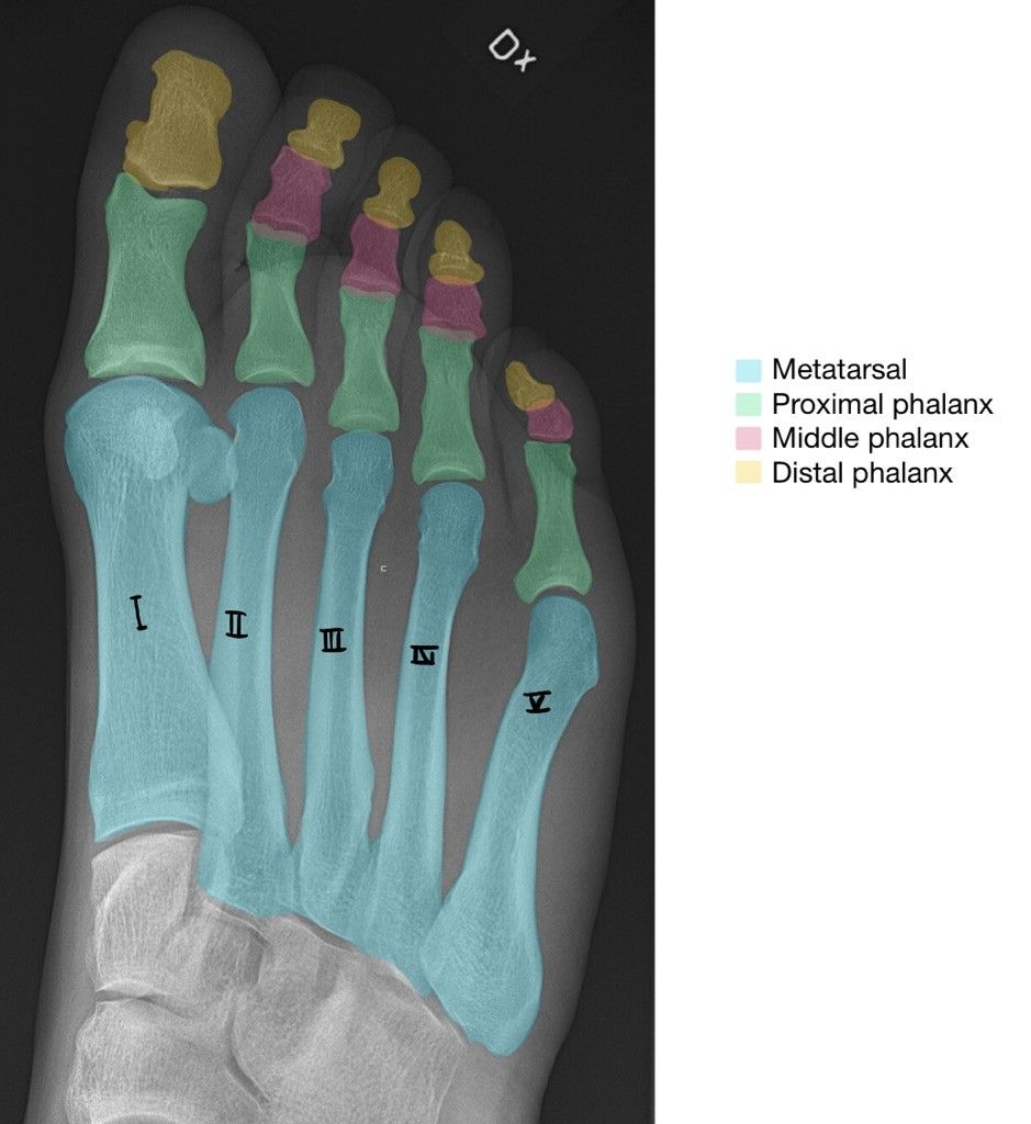 Phalanges Diagram Labelled SimpleMed Phalanges Diagram Labelled SimpleMed