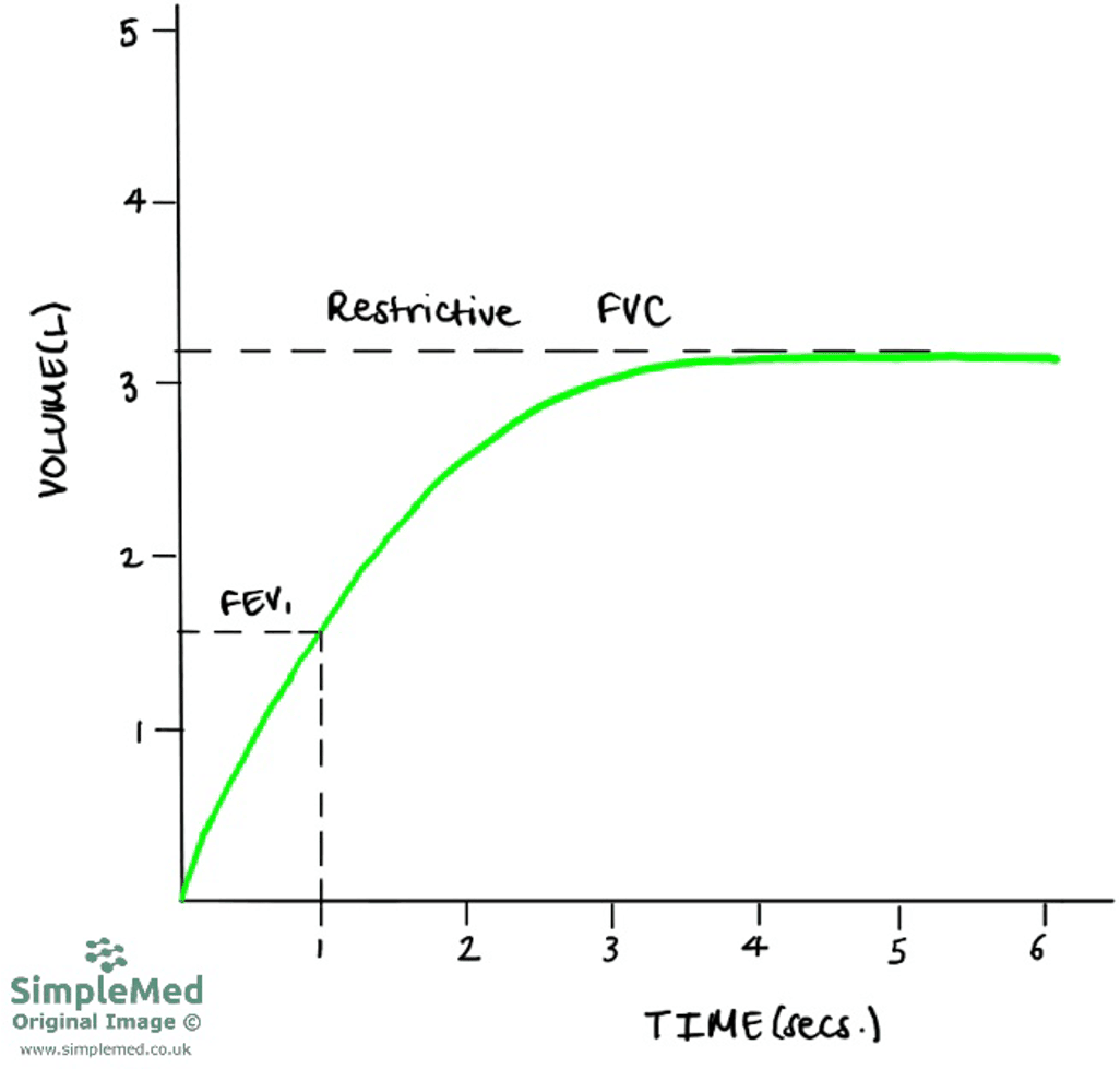Restrictive Time Volume Graph SimpleMed Restrictive Time Volume Graph SimpleMed