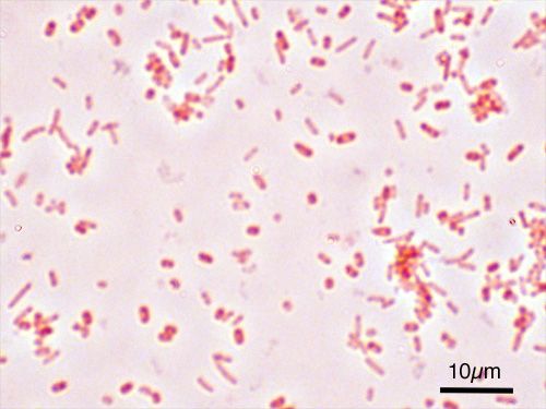 Salmonella Typhi Gram Stain SimpleMed Salmonella Typhi Gram Stain SimpleMed