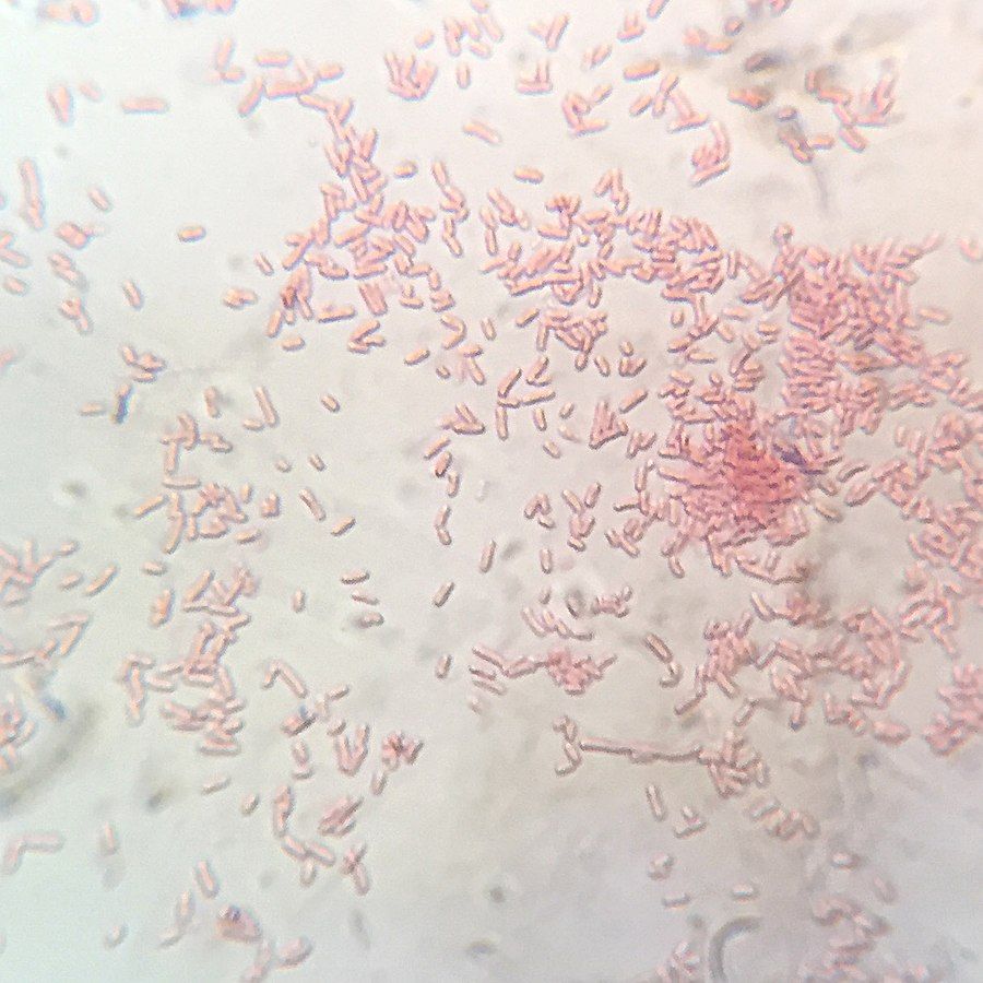 Shigella Flexneri Gram Stain SimpleMed Shigella Flexneri Gram Stain SimpleMed