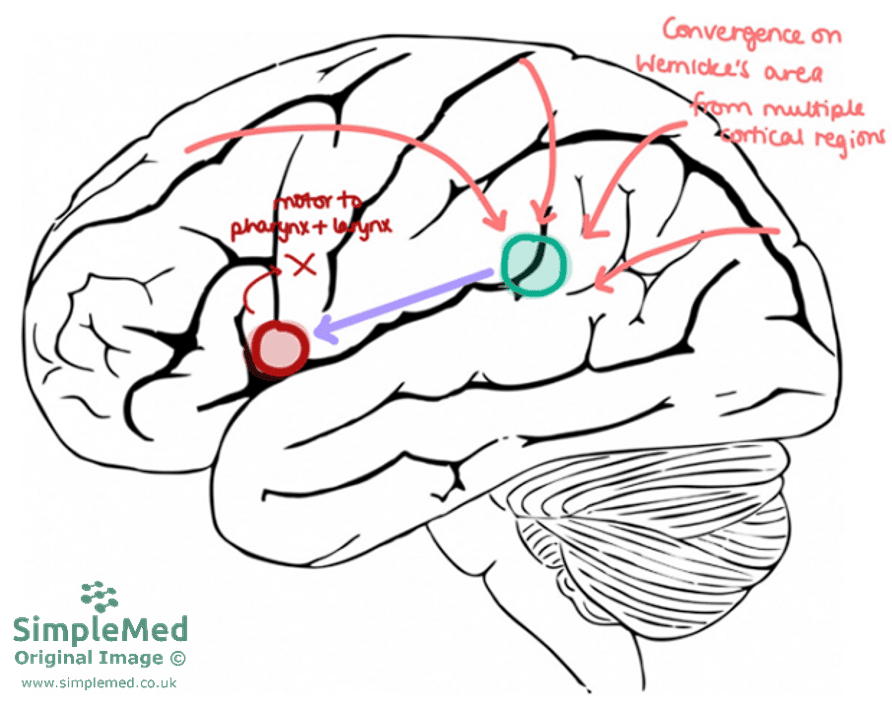 Pathway for Speaking a Though Word SimpleMed Pathway for Speaking a Though Word SimpleMed