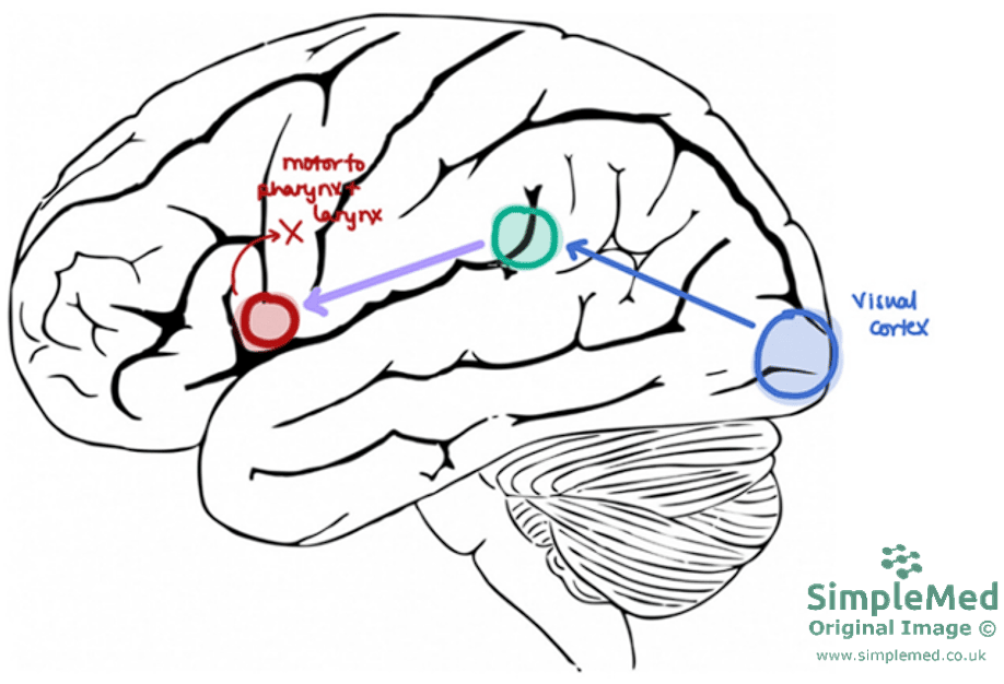 Pathway for Speaking a Written Word SimpleMed Pathway for Speaking a Written Word SimpleMed