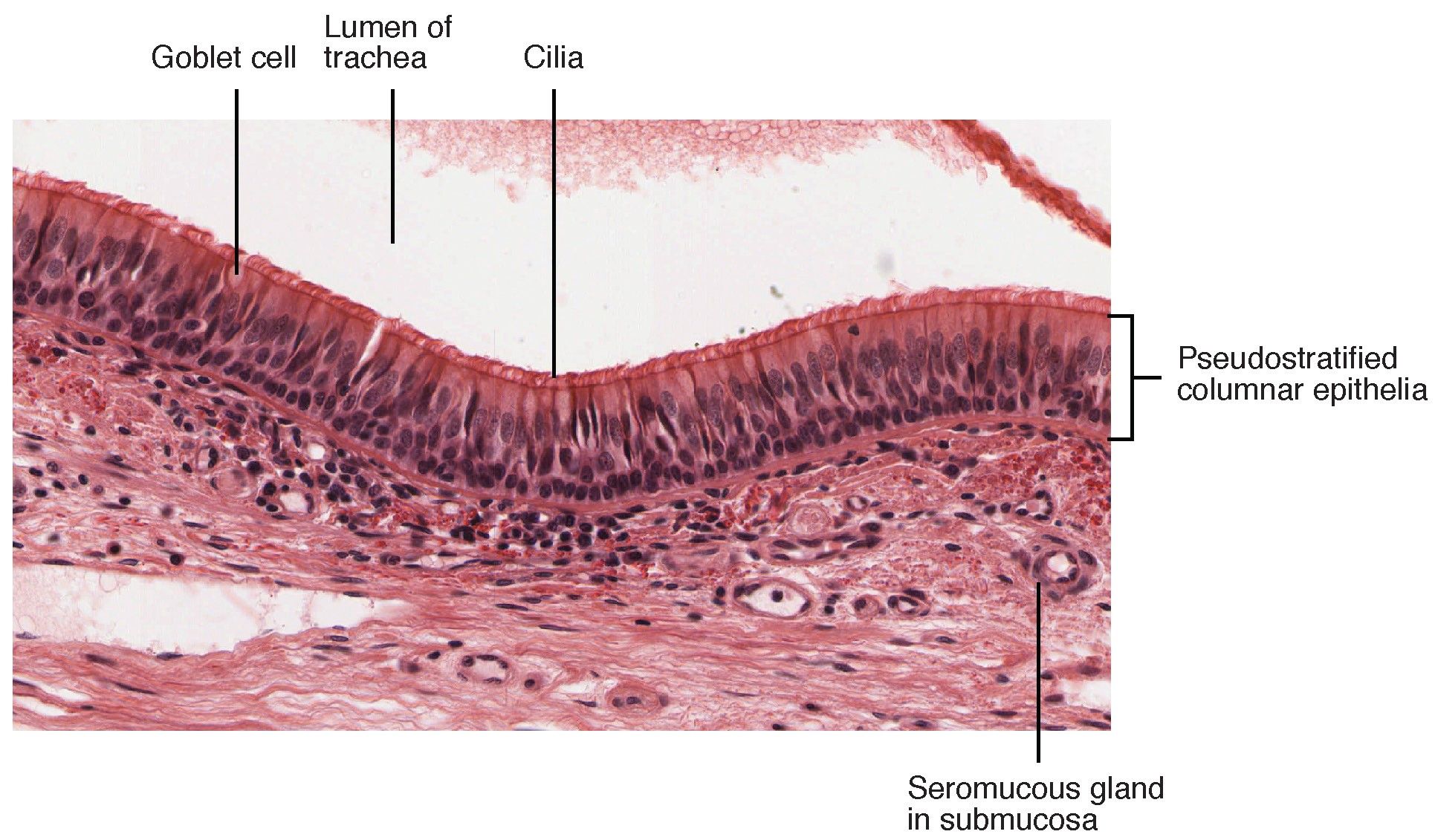 Histological Section of the Trachea SimpleMed Histological Section of the Trachea SimpleMed