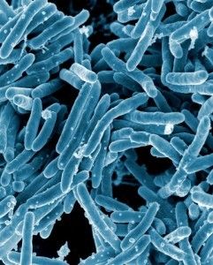 Mycobacterium Tuberculosis SimpleMed Mycobacterium Tuberculosis SimpleMed
