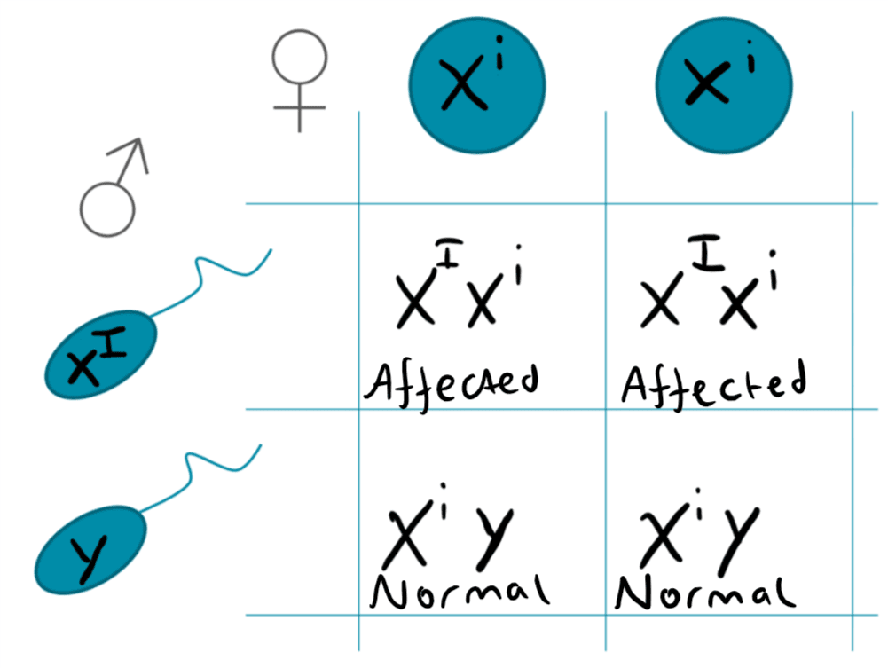 X-Linked Dominant Punnet Square SimpleMed X-Linked Dominant Punnet Square SimpleMed